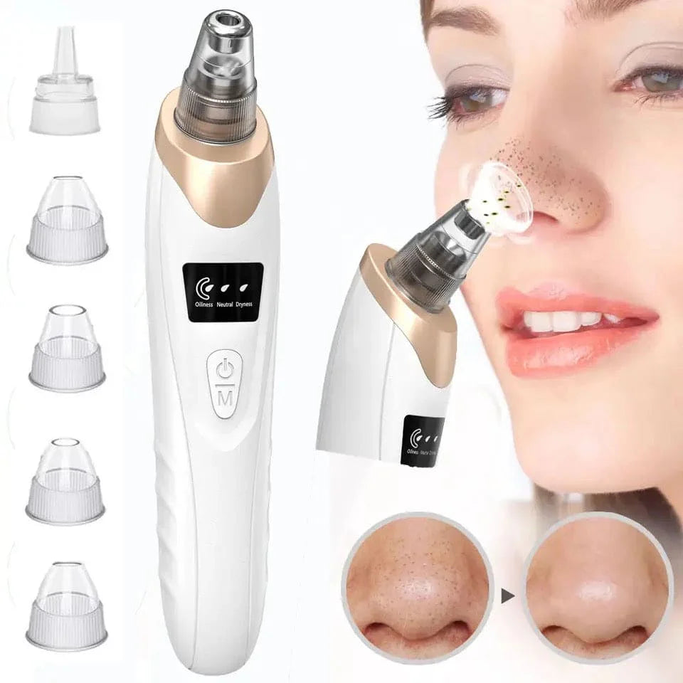 Blackhead Remover & Acne Pore Rechargeable